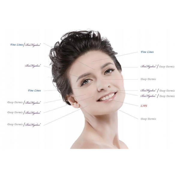 Kwas hialuronowy TOP Q 1ml Deep/Derm/Fine