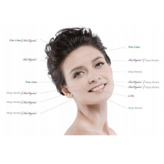 Kwas hialuronowy TOP Q 1ml Deep/Derm/Fine